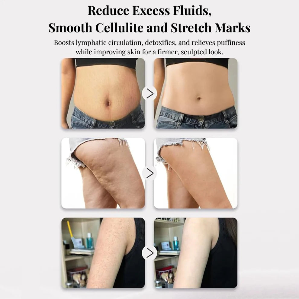 Lymphatic Renewal Massager — Heated Drainage Therapy for Legs, Abdomen & Arms